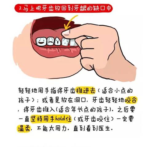 牙外傷04.jpg