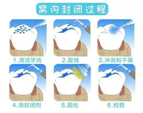 齲齒08.jpg