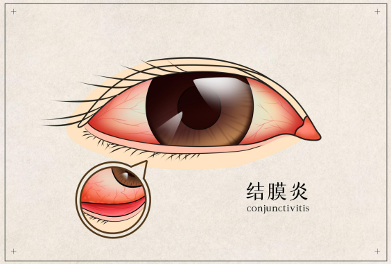 0729-洪澇05.png